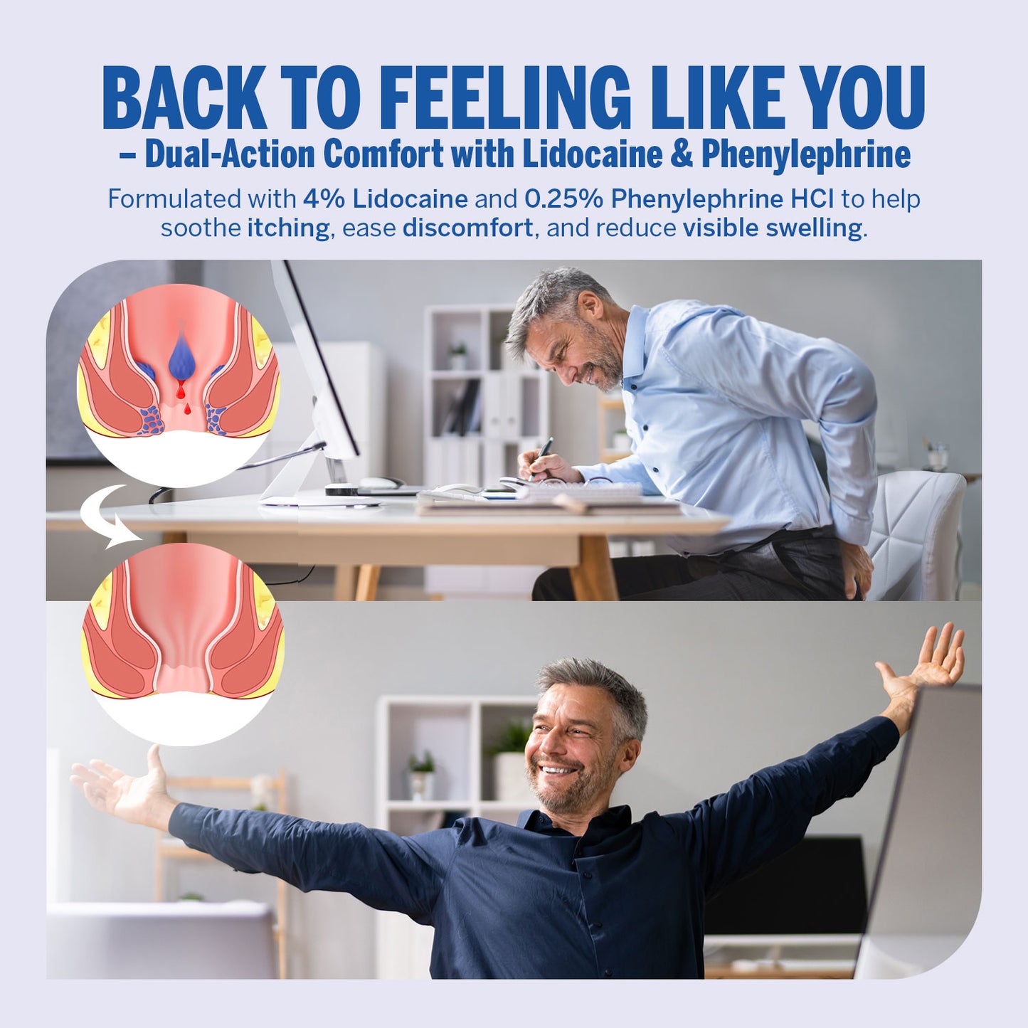 Advanced Hemorrhoid & Fissure Cream (1.7 Oz, Witch Hazel)